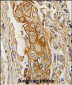 ACPP Antibody (C-term)