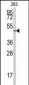 E2F1 Antibody (S332)