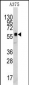 KREMEN1 Antibody (N-term)