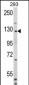 DAAM2 Antibody (N-term)