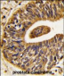 ERBB2 Antibody(C-term Y1248)