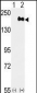 ERBB2 Antibody(C-term Y1248)