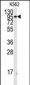 FGFR1 Antibody (Y154)