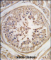 PUM1 Antibody (N-term)