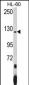 PUM1 Antibody (N-term)