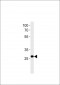 IPF Antibody (C-term)