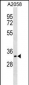 CDK5R1(p35) Antibody (C-term)