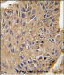 ANTXR1 Antibody (Y382)
