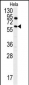 ANTXR1 Antibody (Y382)