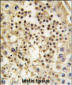 LIN28A Antibody