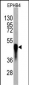 EPHB4 Antibody