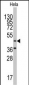 NARS2 Antibody (C-term)