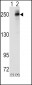 ALK Antibody (Center)