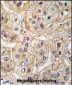 EGFR Antibody (S1070)