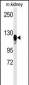 EGFR Antibody (S1070)