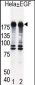 EGFR Antibody (S1070)