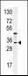 IGFBP3 Antibody (N-term)