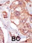 TNK1 Antibody (Center)