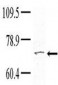 TNK1 Antibody (Center)