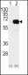 SMAD4 Antibody (T277)