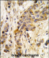 IARS2 Antibody (Center)