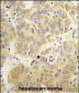 VARS Antibody (N-term)