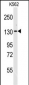 VARS Antibody (N-term)