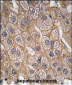 Endophilin B1 Antibody (Y80)