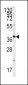 Endophilin B1 Antibody (Y80)