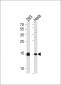 SUMO2/3 Antibody (C-term E69)