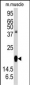 RGS19 Antibody (S151)