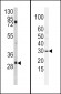 SLUG Antibody (N-term K9)