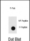 Phospho-ANTXR1(Y382) Antibody
