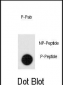 Phospho-Leo1(S551) Antibody