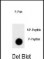 Phospho-PRL(S163) Antibody