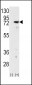 PKC delta Antibody (N-term)