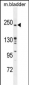 RICTOR Antibody (Center)