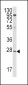 APOA1 Antibody (N-term)