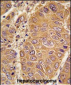 APOA1 Antibody (N-term)