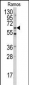 MEN1 Antibody (S128)