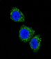 MEN1 Antibody (T594)