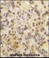 MEN1 Antibody (T594)