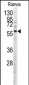 MEN1 Antibody (T594)