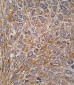 GIT1 Antibody (Y510)