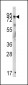 GIT1 Antibody (Y510)