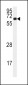 CAMK2A Antibody (C-term E370)