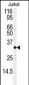 JUND Antibody (S255)