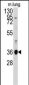 ANXA2 Antibody (N-term)