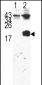 FKBP12 Antibody (Center)