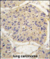 FKBP12 Antibody (Center)